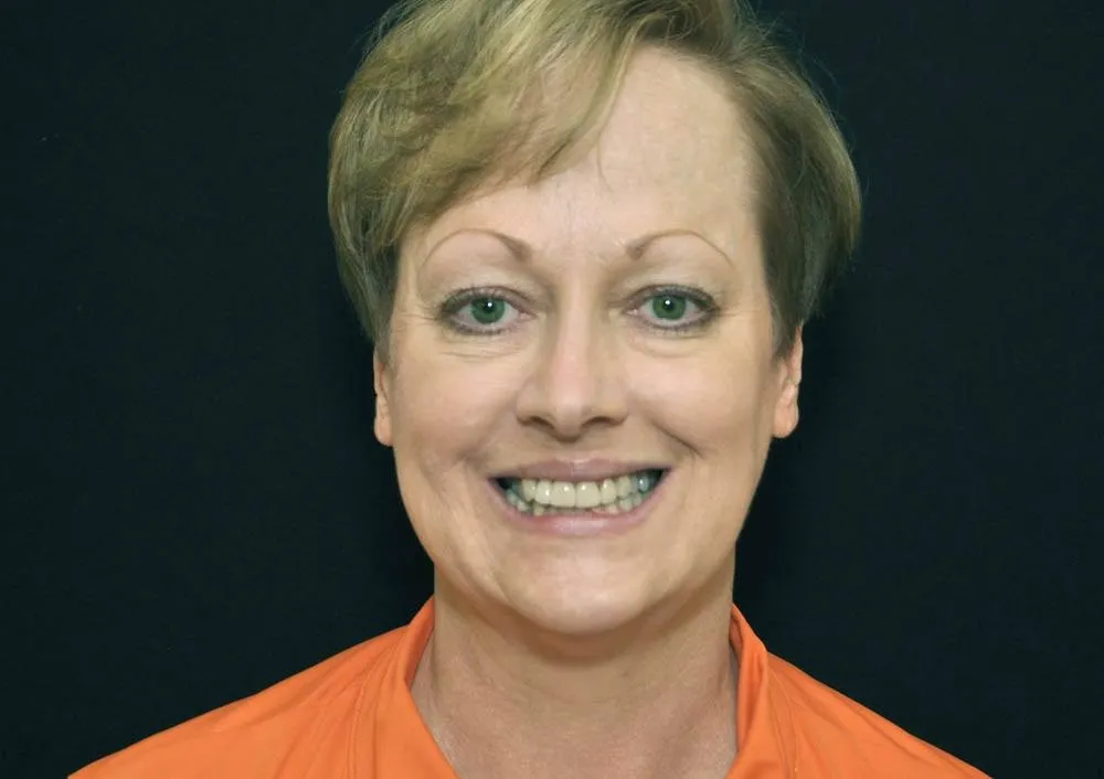 Patient B before treatment