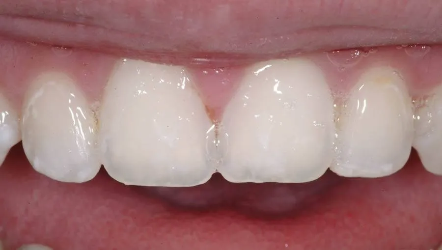 Patient C after treatment