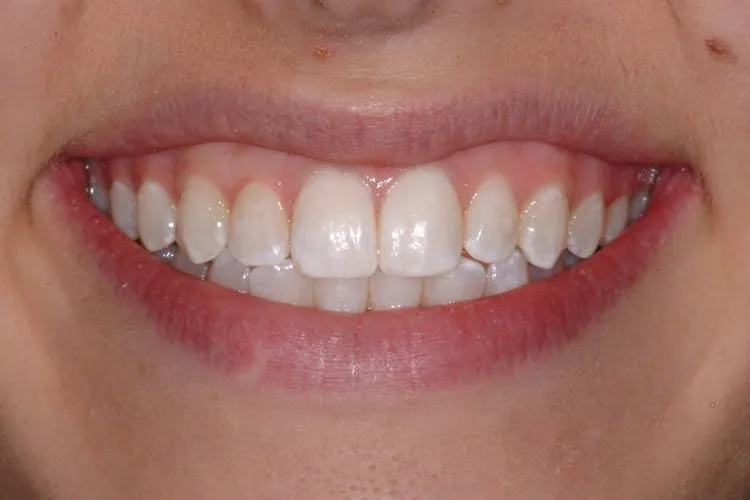 Patient H after treatment