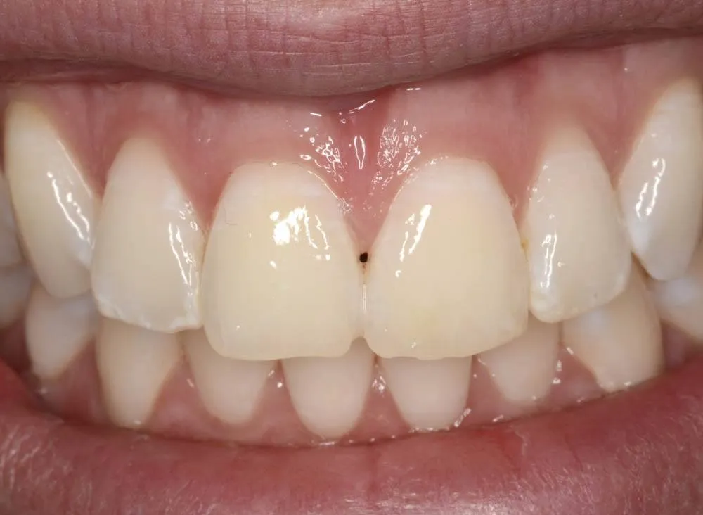 Patient J after treatment
