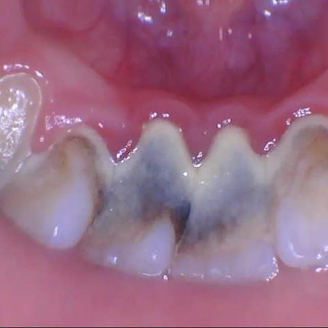 Patient K before treatment