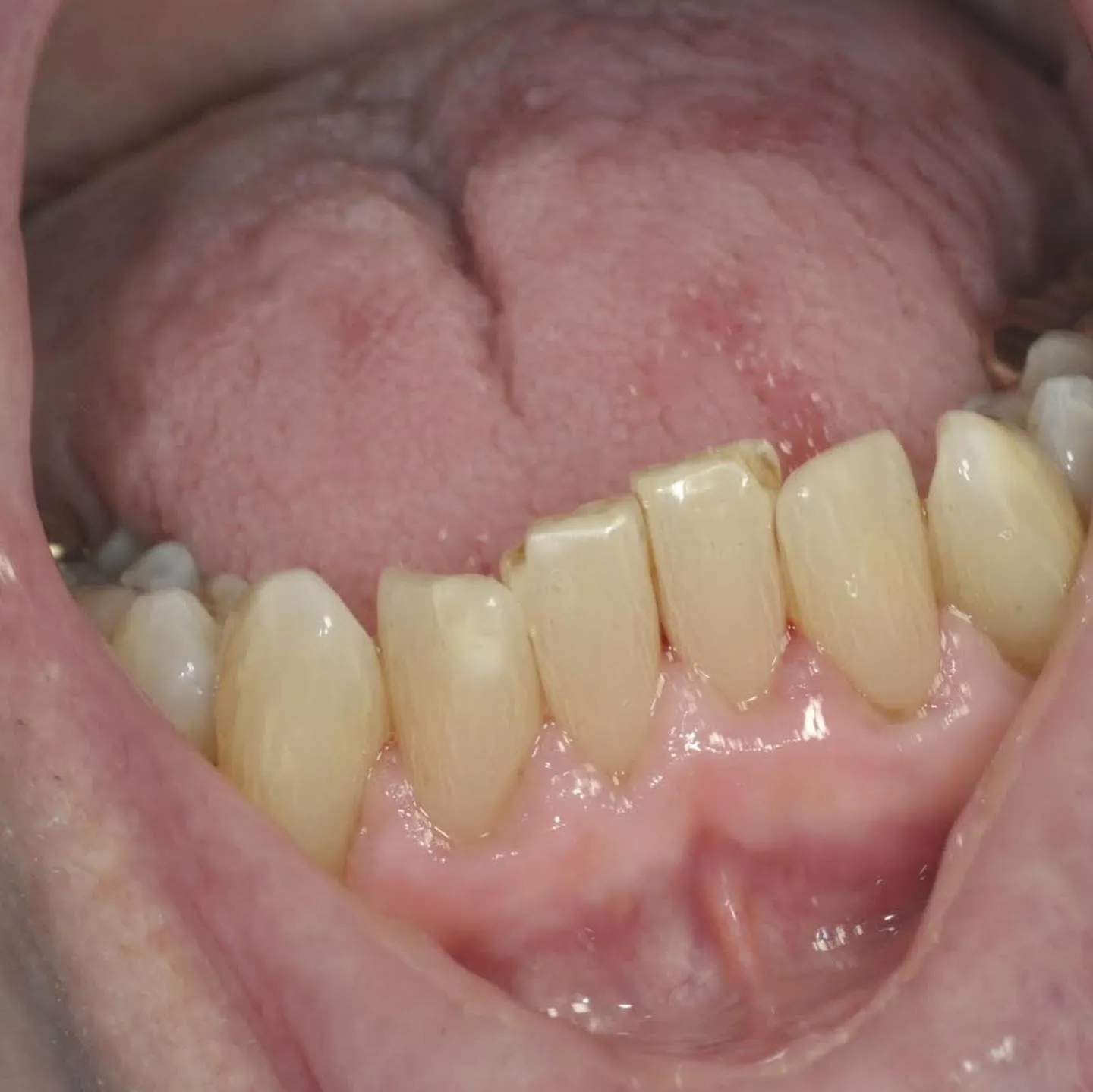 Patient L after treatment