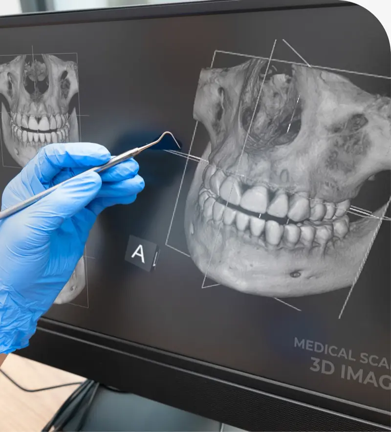 3D Cone Beam Imaging in Layton, UT: Your 3D Dental X-Ray Guide