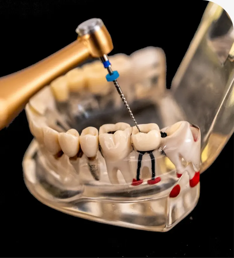 Tooth Extractions in Layton, UT: A Clear Patient Guide
