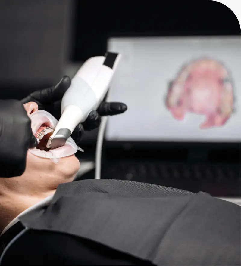 Intraoral Camera in Layton, UT