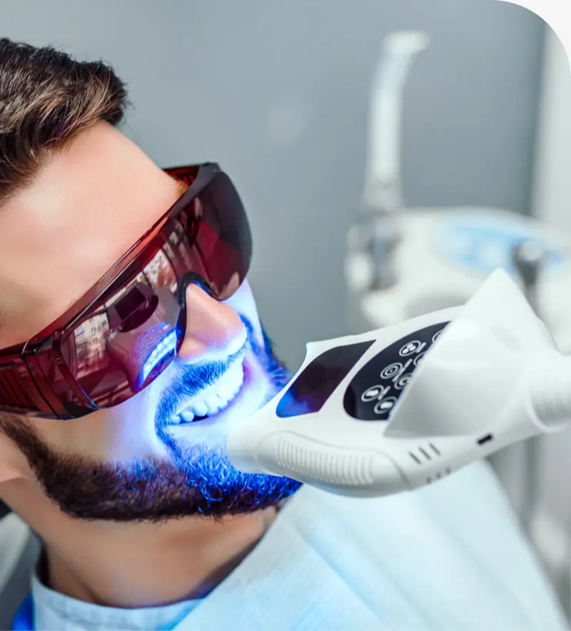 Take-Home Teeth Whitening in Layton, UT: What Patients Should Know
